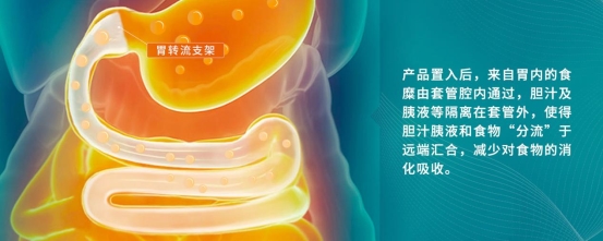 BL 原理海报