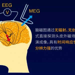 昆迈医疗完成数千万元Pre-A轮融资，纳通科技集团领投